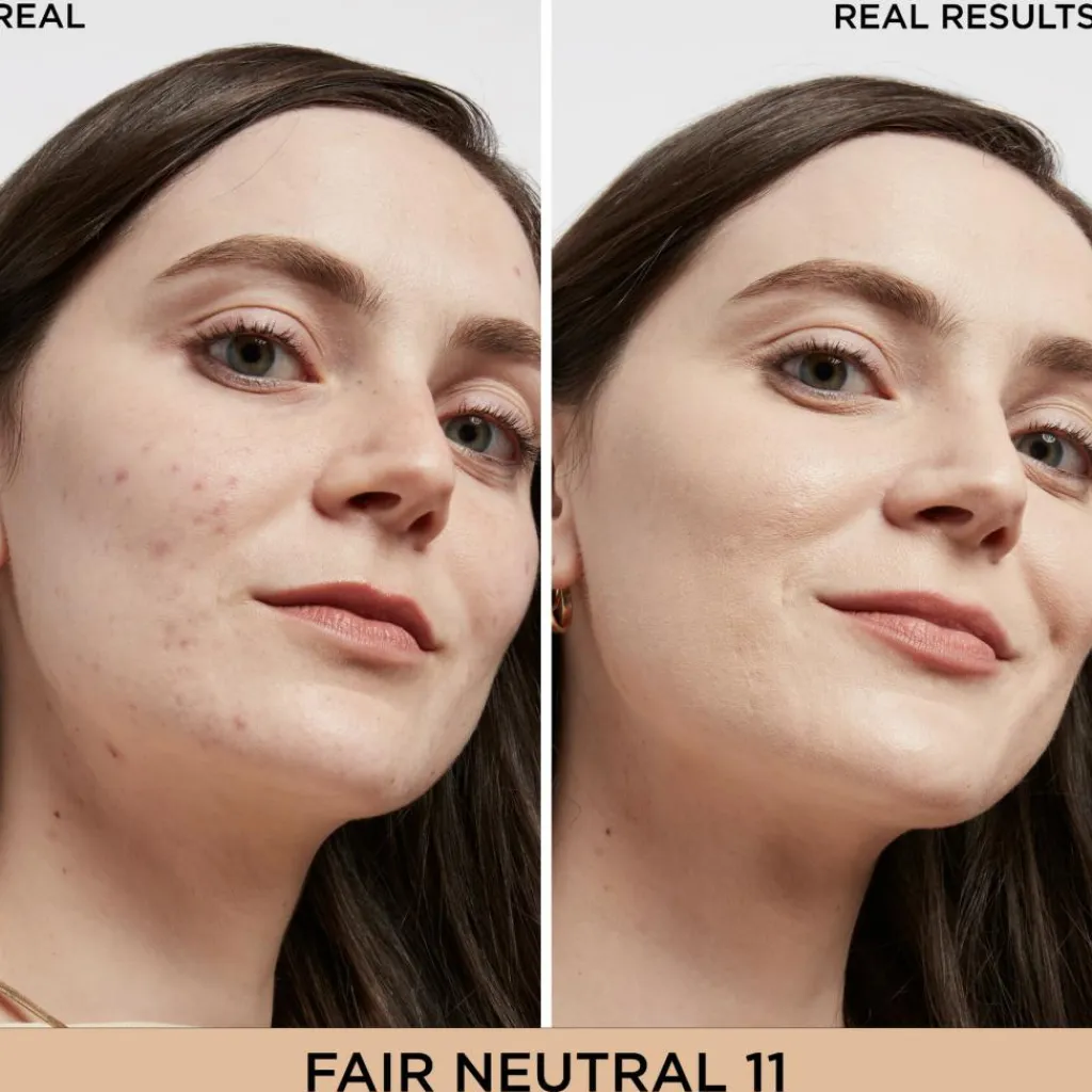 IT Cosmetics Concealer<Bye Bye Dark Spots Concealer + Serum