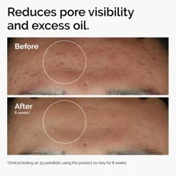 The Ordinary Serum<Niacinamide 10% + Zinc 1%