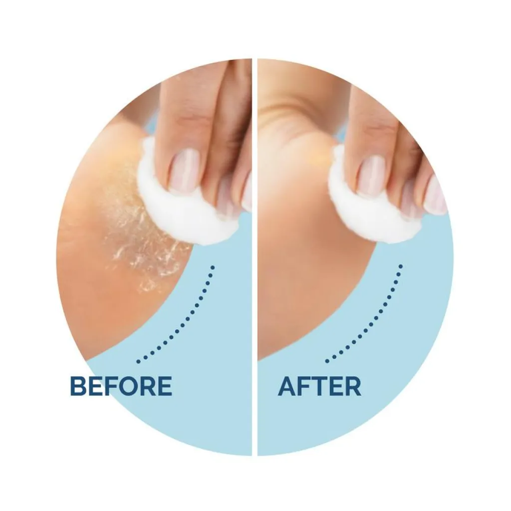 Scholl Fodpleje<Refill Velvet Smooth Eksfolierende