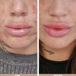 Australian Bodycare Sampak Ansigtspleje< Ansigtspleje|Sampak