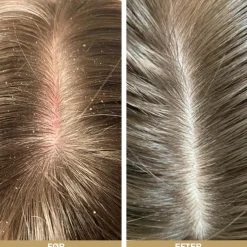 Australian Bodycare Sampak<Sampak Skæl og Tør Hovedbund