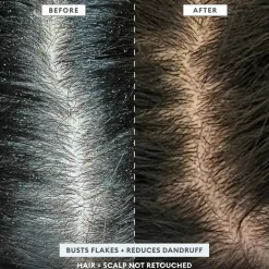 Briogeo Hovedbundspleje<Scalp Revival™ MegaStrength+ Dandruff Relief Shampoo Charcoal + AHA/BHA