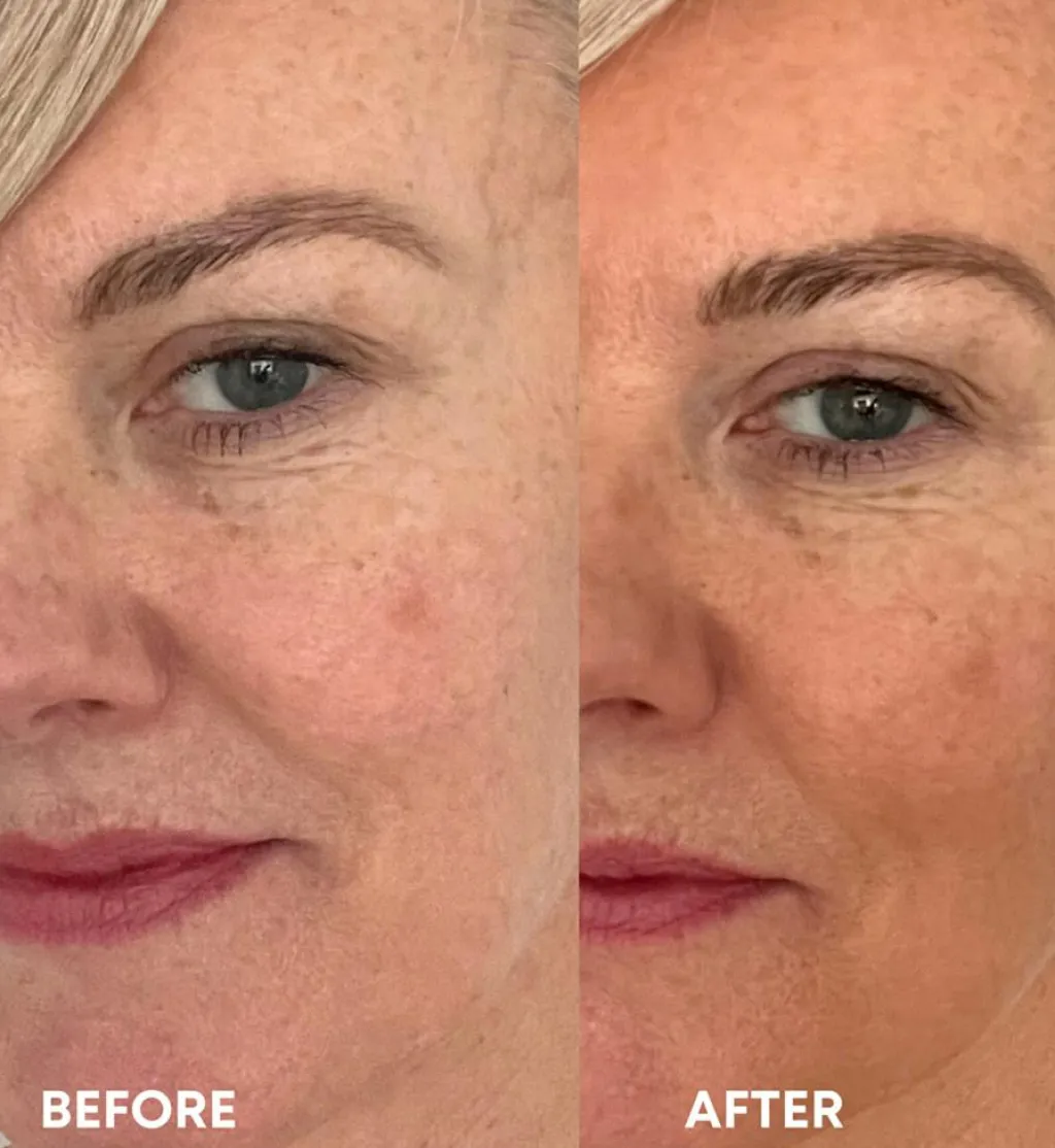 Vita Liberata Selvbrunere>Self Tanning Anti-age Serum
