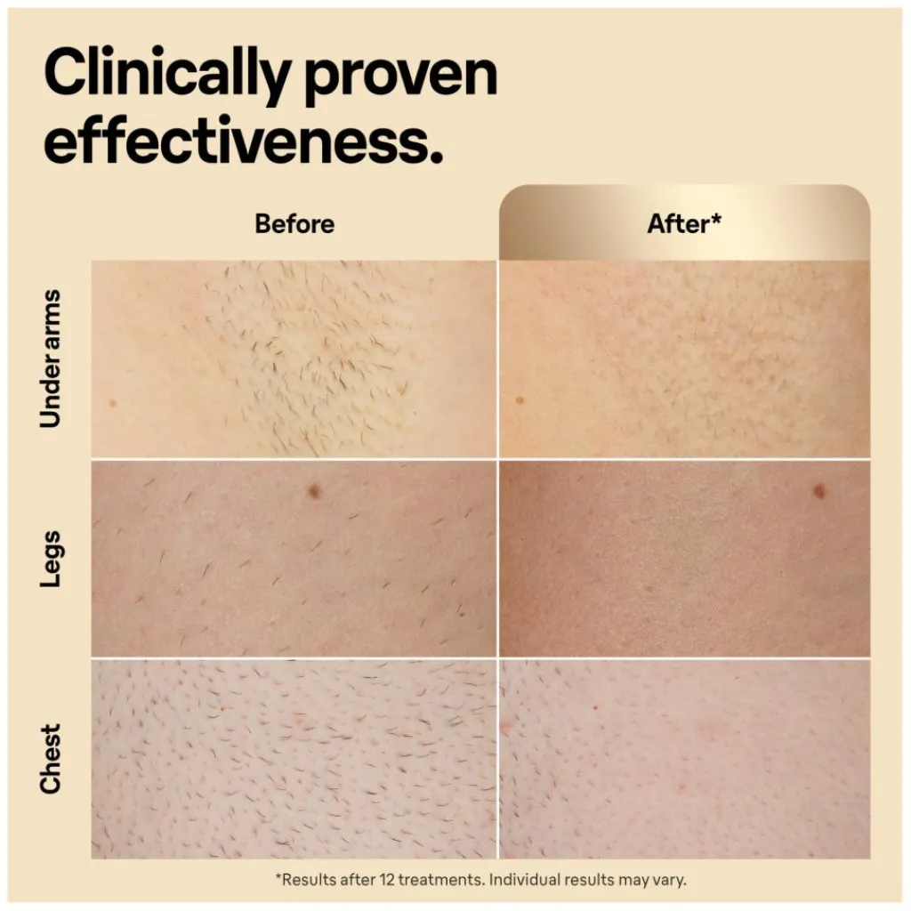 Braun Silk Expert Pro< Epilatorer